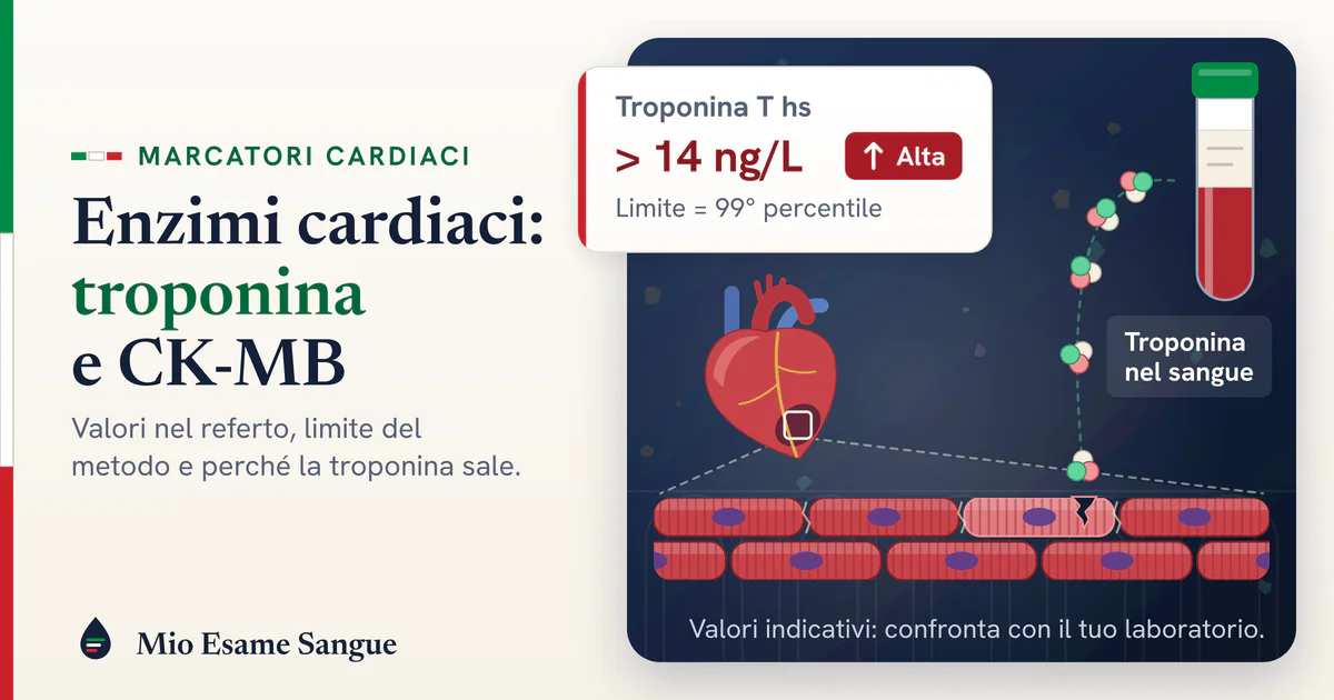 Cuore e fibre del miocardio, con una cellula incrinata che libera troponina verso la provetta, e scheda hs-cTnT oltre 14 ng/L