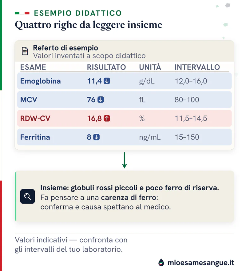 Referto di esempio con emoglobina 11,4, MCV 76 e ferritina 8 segnati bassi e RDW-CV 16,8 alto, e la sintesi del quadro