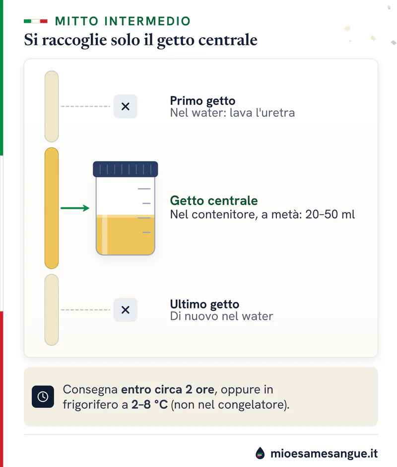 Flusso di urina per l'ACR diviso in tre tempi: inizio e fine nel water, parte centrale nel contenitore riempito a metà