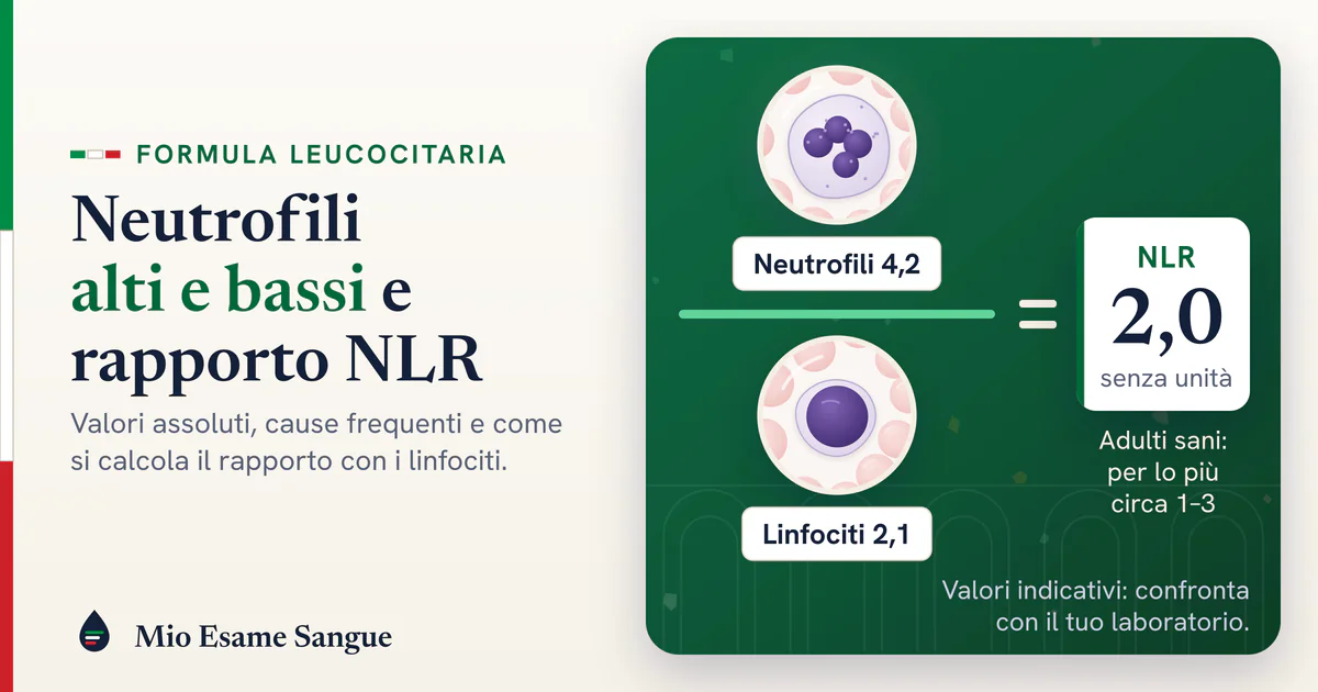 Neutrofilo e linfocita sotto due lenti divise da una linea di frazione: neutrofili 4,2 su linfociti 2,1, NLR 2,0