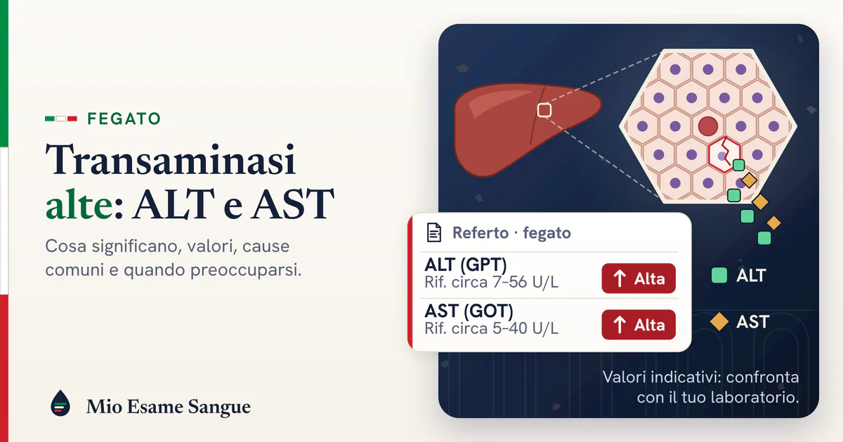 Fegato con ingrandimento di cellule epatiche, una incrinata che libera enzimi, e referto delle transaminasi ALT e AST alte